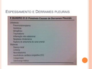ESPESSAMENTO E DERRAMES PLEURAIS
 