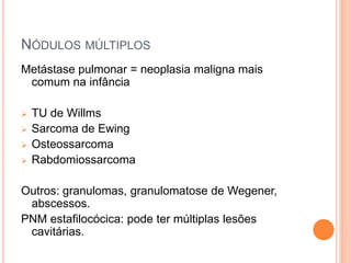 NÓDULOS MÚLTIPLOS
Metástase pulmonar = neoplasia maligna mais
comum na infância
 TU de Willms
 Sarcoma de Ewing
 Osteossarcoma
 Rabdomiossarcoma
Outros: granulomas, granulomatose de Wegener,
abscessos.
PNM estafilocócica: pode ter múltiplas lesões
cavitárias.
 