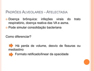 PADRÕES ALVEOLARES - ATELECTASIA
 Doença brônquica: infeções virais do trato
respiratório, doença reativa das VA e asma.
 Pode simular consolidação bacteriana
Como diferenciar?
Há perda de volume, desvio de fissuras ou
mediastino
Formato retificado/linear da opacidade
 
