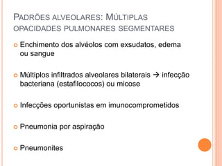 PADRÕES ALVEOLARES: MÚLTIPLAS
OPACIDADES PULMONARES SEGMENTARES
 Enchimento dos alvéolos com exsudatos, edema
ou sangue
 Múltiplos infiltrados alveolares bilaterais  infecção
bacteriana (estafilococos) ou micose
 Infecções oportunistas em imunocomprometidos
 Pneumonia por aspiração
 Pneumonites
 