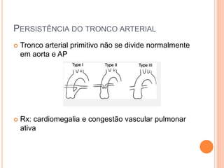 PERSISTÊNCIA DO TRONCO ARTERIAL
 Tronco arterial primitivo não se divide normalmente
em aorta e AP
 Rx: cardiomegalia e congestão vascular pulmonar
ativa
 