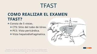 Tfast Ultrasonido de torax no cardiaco, .pptx