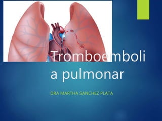 Tromboemboli
a pulmonar
DRA MARTHA SANCHEZ PLATA
 