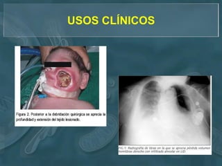 USOS CLÍNICOS
 