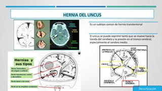 Uncus traumatismo cráneo-encefálico (imagenologia medica) | PPTX
