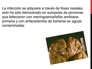 La infección se adquiere a través de fosas nasales,
esto ha sido demostrado en autopsias de personas
que fallecieron con meningoencefalitis amibiana
primaria y con antecedentes de bañarse en aguas
contaminadas
 