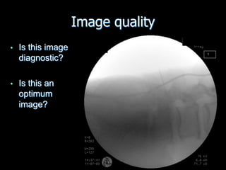 Image quality
• Is this image
diagnostic?
• Is this an
optimum
image?
 