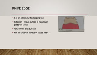 Principle of tooth preparation prosthodontics | PPTX