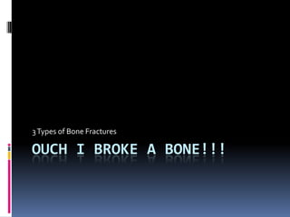 Ouch I Broke a Bone!!!By: Marguerite Smith 3 Types of Bone Fractures 