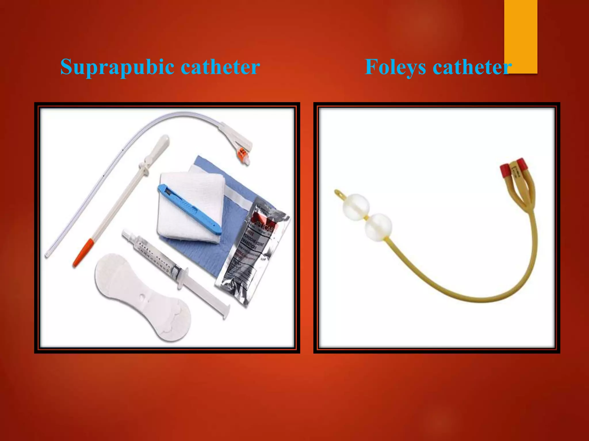 Suprapubic catheter Foleys catheter
 