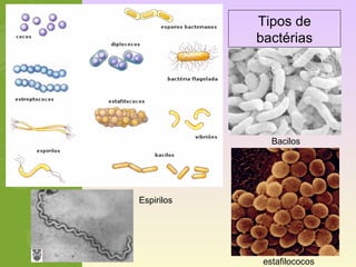 Tipos de 
bactérias 
Bacilos 
estafilococos 
Espirilos 
 
