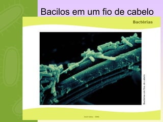 Bacilos em um fio de cabelo 
 