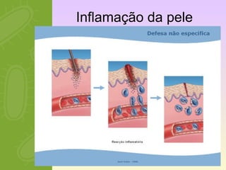 Inflamação da pele 
 