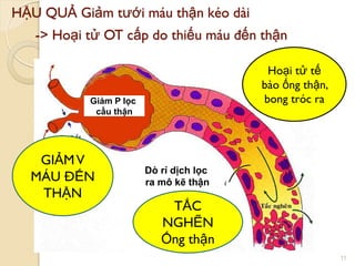 HẬU QUẢ Giảm tƣới máu thận kéo dài
-> Hoại tử OT cấp do thiếu máu đến thận
11
Giảm P lọc
cầu thận
GIẢMV
MÁU ĐẾN
THẬN
Hoại tử tế
bào ống thận,
bong tróc ra
TẮC
NGHẼN
Ống thận
Dò rỉ dịch lọc
ra mô kẽ thận
 