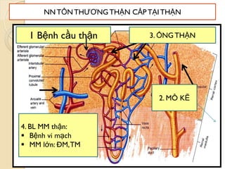 39
1 Bệnh cầu thận 3. ỐNG THẬN
2. MÔ KẼ
4. BL MM thận:
 Bệnh vi mạch
 MM lớn: ĐM,TM
NN TỔNTHƢƠNG THẬN CẤP TẠITHẬN
 