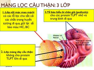 MÀNG LỌC CẦU THẬN: 3 LỚP
1. Lớp nội mạc mao mạch:
có các lỗ lọc cho tất cả
các chất trong huyết
tƣơng đi qua, giữ lại tế
bào máu: HC, BC
2. Lớp màng đáy cầu thận:
không cho protein
TLPT lớn đi qua
3.Tế bào biểu bì chân giả (pedicels):
cho các protein TLPT nhỏ và
trung bình đi qua
 