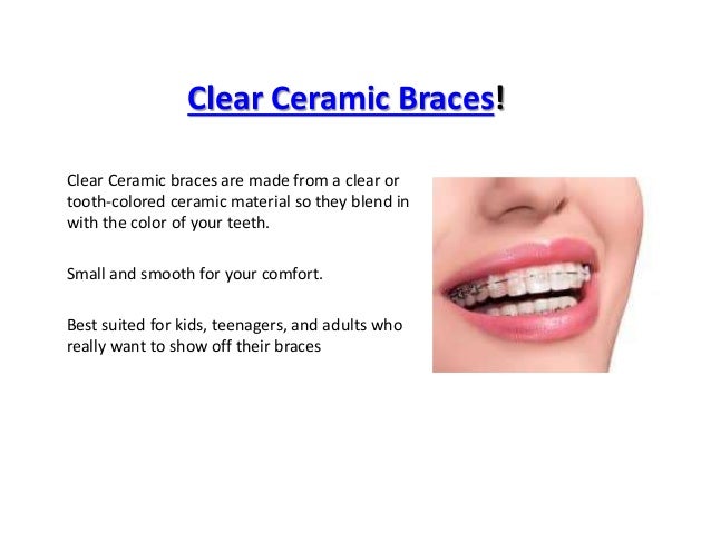 Orthodontist Colorado
