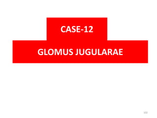 GLOMUS JUGULARAE
CASE-12
102
 
