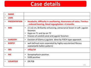 • NAME
• UMR
• PRESENTATION • Headache, difficulty in swallowing, Hoarseness of voice, Tinnitus
, reduced hearing, Nasal regurgitation × 6 months
• MRI • 2.5 x2 cm, Brilliantly enhancing, extracranial lesion in Left jugular
foramen
• Hypo on T1 and Iso on T2
• Erosion of carotid canal and jugular foramen
• SURGERY • Excision of Glomus jugulare done by FISCH type approach
• BIOPSY • well defined nests separated by highly vascularized fibrous
septae[zelle ballen pattern]
• SRS • 14Gy/1#
• IHC • Synaptophysin positive
• S100 positive
• COURTESY • DR PSB
Case details
103
 