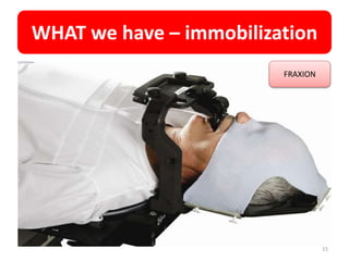 WHAT we have – immobilization
15
FRAXION
 