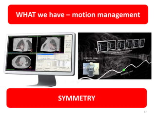 WHAT we have – motion management
17
SYMMETRY
 