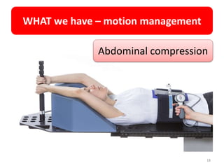 WHAT we have – motion management
18
Abdominal compression
 