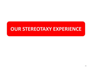 OUR STEREOTAXY EXPERIENCE
36
 