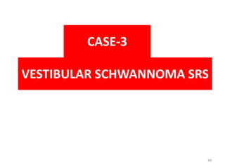 VESTIBULAR SCHWANNOMA SRS
CASE-3
48
 