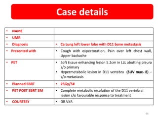 • NAME
• UMR
• Diagnosis • Ca Lung left lower lobe with D11 bone metastasis
• Presented with • Cough with expectoration, Pain over left chest wall,
Upper backache
• PET • Soft tissue enhancing lesion 5.2cm in LLL abutting pleura
s/o primary
• Hypermetabolic lesion in D11 vertebra (SUV max- 8) –
s/o metastasis
• Planned SBRT • 25Gy/5#
• PET POST SBRT 3M • Complete metabolic resolution of the D11 vertebral
lesion s/o favourable response to treatment
• COURTESY • DR VKR
Case details
66
 