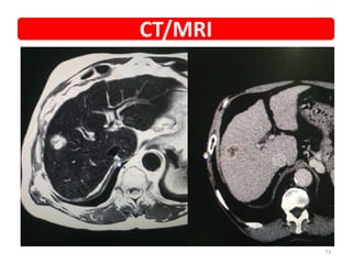 CT/MRI
73
 