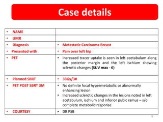 • NAME
• UMR
• Diagnosis • Metastatic Carcinoma Breast
• Presented with • Pain over left hip
• PET • Increased tracer uptake is seen in left acetabulum along
the posterior margin and the left ischium showing
sclerotic changes (SUV max - 6)
• Planned SBRT • 33Gy/3#
• PET POST SBRT 3M • No definite focal hypermetabolic or abnormally
enhancing lesion
• Increased sclerotic changes in the lesions noted in left
acetabulum, ischium and inferior pubic ramus – s/o
complete metabolic response
• COURTESY • DR PSB
Case details
78
 