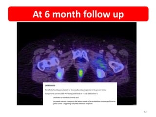 82
At 6 month follow up
 