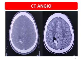 CT ANGIO
88
 