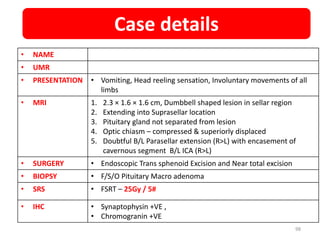 • NAME
• UMR
• PRESENTATION • Vomiting, Head reeling sensation, Involuntary movements of all
limbs
• MRI 1. 2.3 × 1.6 × 1.6 cm, Dumbbell shaped lesion in sellar region
2. Extending into Suprasellar location
3. Pituitary gland not separated from lesion
4. Optic chiasm – compressed & superiorly displaced
5. Doubtful B/L Parasellar extension (R>L) with encasement of
cavernous segment B/L ICA (R>L)
• SURGERY • Endoscopic Trans sphenoid Excision and Near total excision
• BIOPSY • F/S/O Pituitary Macro adenoma
• SRS • FSRT – 25Gy / 5#
• IHC • Synaptophysin +VE ,
• Chromogranin +VE
Case details
98
 