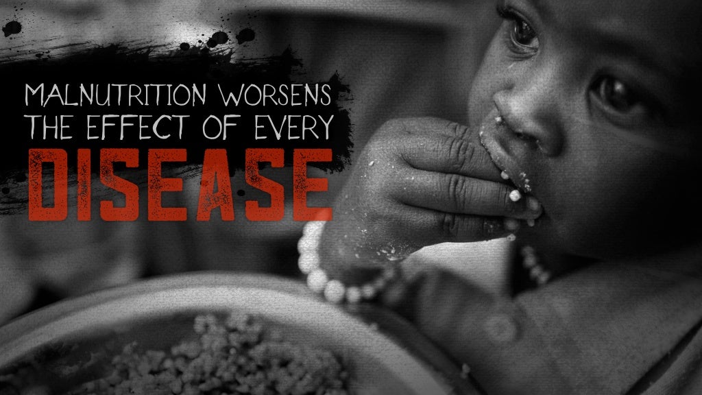 Disease MALNUTRITION WORSENS THE EFFECT disease-malnutrition-worsens-the-effect