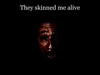 They skinned me alive

 