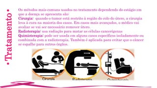 •Tratamento• Os métodos mais comuns usados no tratamento dependendo do estágio em
que a doença se apresenta são:
Cirurgia: quando o tumor está restrito à região do colo do útero, a cirurgia
leva à cura na maioria dos casos. Em casos mais avançados, o médico vai
avaliar se vai ser necessário remover útero.
Radioterapia: usa radiação para matar as células cancerígenas
Quimioterapia: pode ser usada em alguns casos específicos isoladamente ou
combinada com a radioterapia. Também é aplicada para evitar que o câncer
se espalhe para outros órgãos.
 