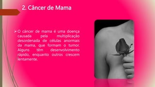 2. Câncer de Mama
O câncer de mama é uma doença
causada pela multiplicação
desordenada de células anormais
da mama, que formam o tumor.
Alguns têm desenvolvimento
rápido, enquanto outros crescem
lentamente.
 