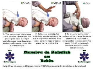 http://rioenfermagem.blogspot.com.br/2013/06/manobra-de-heimlich-em-bebes.html
 