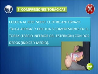 5 COMPRESIONES TORÁCICAS


COLOCA AL BEBE SOBRE EL OTRO ANTEBRAZO
“BOCA ARRIBA” Y EFECTUA 5 COMPRESIONES EN EL
TORAX (TERCIO INFERIOR DEL ESTERNÓN) CON DOS
DEDOS (INDICE Y MEDIO).
 