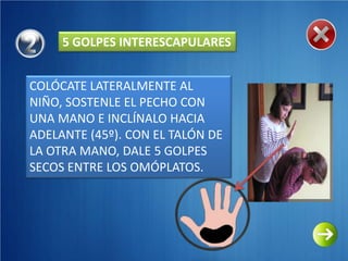 5 GOLPES INTERESCAPULARES


COLÓCATE LATERALMENTE AL
NIÑO, SOSTENLE EL PECHO CON
UNA MANO E INCLÍNALO HACIA
ADELANTE (45º). CON EL TALÓN DE
LA OTRA MANO, DALE 5 GOLPES
SECOS ENTRE LOS OMÓPLATOS.
 