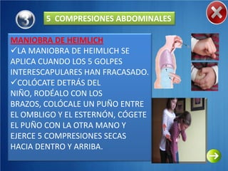 5 COMPRESIONES ABDOMINALES

MANIOBRA DE HEIMLICH
LA MANIOBRA DE HEIMLICH SE
APLICA CUANDO LOS 5 GOLPES
INTERESCAPULARES HAN FRACASADO.
COLÓCATE DETRÁS DEL
NIÑO, RODÉALO CON LOS
BRAZOS, COLÓCALE UN PUÑO ENTRE
EL OMBLIGO Y EL ESTERNÓN, CÓGETE
EL PUÑO CON LA OTRA MANO Y
EJERCE 5 COMPRESIONES SECAS
HACIA DENTRO Y ARRIBA.
 