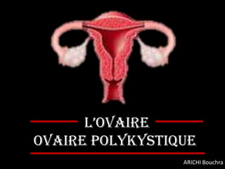 L’ovaire
Ovaire polykystique
                 ARICHI Bouchra
 