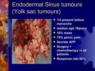 Endodermal Sinus tumours (Yolk sac tumours) 1/3 present before menarche median age 18years 10% mass 75% pelvic pain Secrete AFP Surgery + chemotherapy in all patients  Response rate 60% 