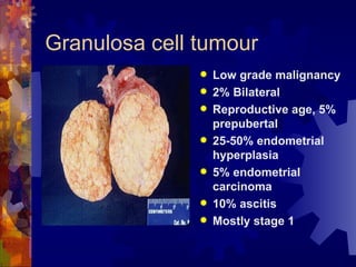 Granulosa cell tumour Low grade malignancy 2% Bilateral Reproductive age, 5% prepubertal 25-50% endometrial hyperplasia 5% endometrial carcinoma 10% ascitis Mostly stage 1 