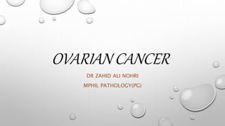 OVARIAN CANCER
DR ZAHID ALI NOHRI
MPHIL PATHOLOGY(PG)
 