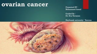ovarian cancer Presented BY :
Mohammed Jamal
Guided By :
Dr. Eva Torosyan
Haybusak university- Yerevan
 
