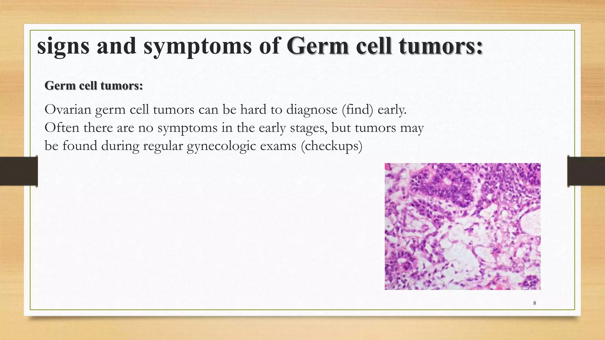 Ovarian cancer .pptx