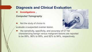  Investigations ,,
Computed Tomography
 Not the study of choice to
evaluate a suspected ovarian lesion.
 the sensitivity, specificity, and accuracy of CT for
characterizing benign versus malignant lesions are reported
to be 89%, 96% to 99%, and 92% to 94%, respectively.
Diagnosis and Clinical Evaluation
 
