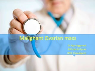 Malignant Ovarian mass
Dr Ajay Aggarwal
MD obs & Gynae
(PGI, Chandigarh)
 
